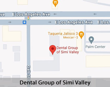 Map image for Teeth Whitening in Simi Valley, CA