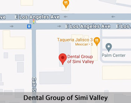 Map image for Options for Replacing Missing Teeth in Simi Valley, CA